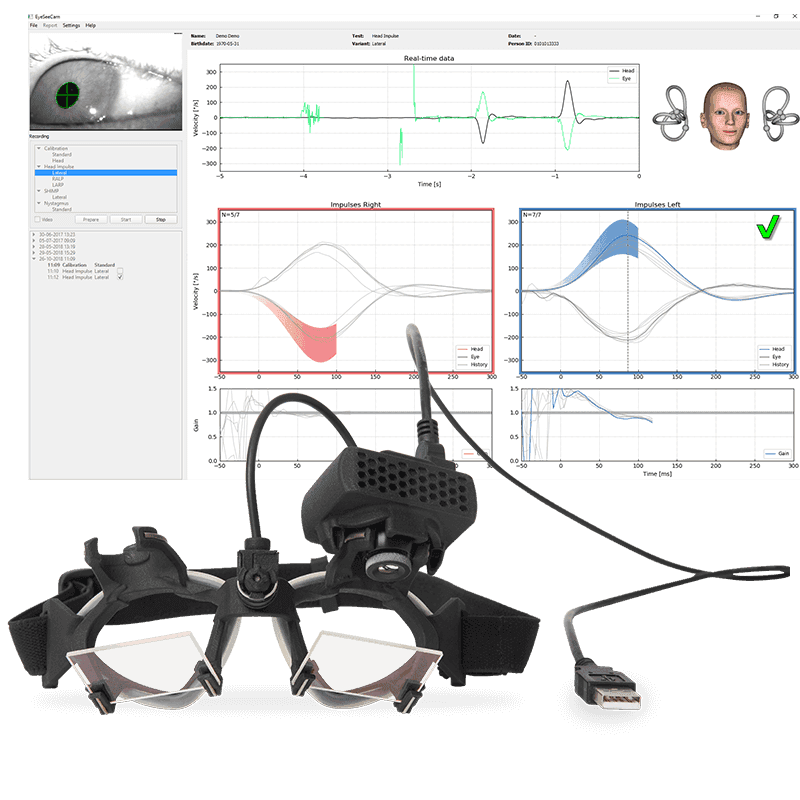 Interacoustics VisualEyes EyeSeeCam